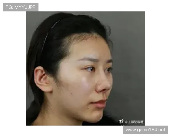 判罚取消规则的适用标准是什么？新手可以避免吗？